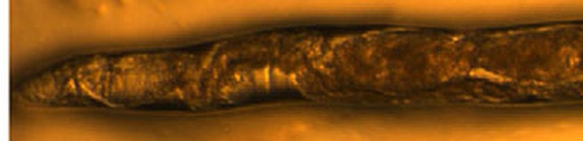 Micrograph of a day-16 adult C. elegans, visibly deteriorated